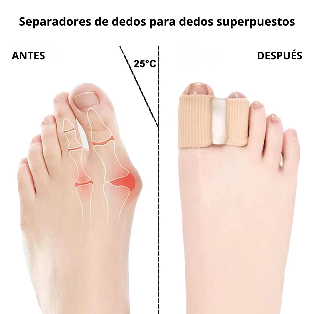 Aligny™ Separadores de dedos elásticos