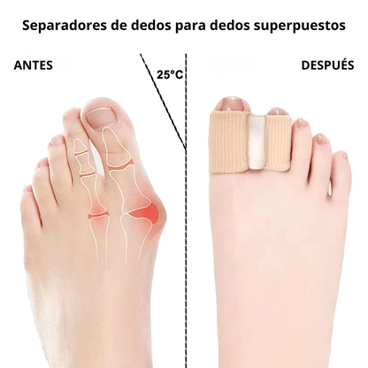 Aligny™ Separadores de dedos elásticos