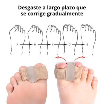 Aligny™ Separadores de dedos elásticos